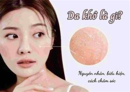 ảnh chụp màn hình cách trị da đầu khô bong tróc tại nhà
