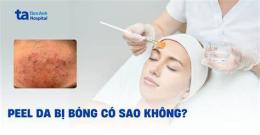 ảnh chụp màn hình peel da mấy ngày thì bong