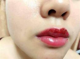 ảnh chụp màn hình phun môi 3 ngày đã bong có sao không