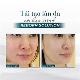 ảnh chụp màn hình sản phẩm peel da không bong tróc