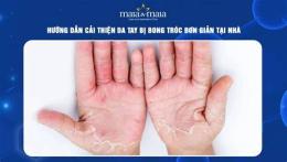 ảnh chụp màn hình tại sao da tay bị bong tróc
