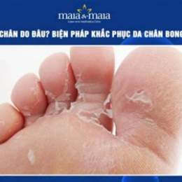 da chân khô bong tróc