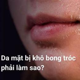da mặt bị khô bong tróc phải làm sao