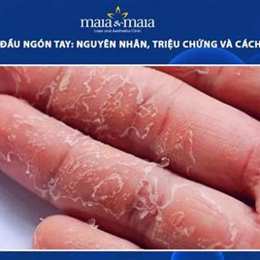 da tay bị bong tróc là bệnh gì