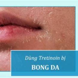 dùng tretinoin bị bong da nên làm gì