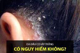 giao diện app da đầu bị bong tróc