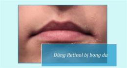 giao diện app dùng retinol bị bong da