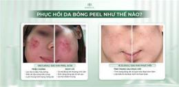 giao diện app peel da bị bỏng