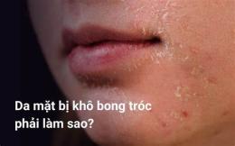 hướng dẫn sử dụng da bị bong tróc