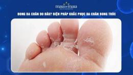 hướng dẫn sử dụng da chân bị bong tróc