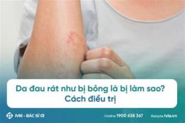 hướng dẫn sử dụng da đau rát như bị bỏng