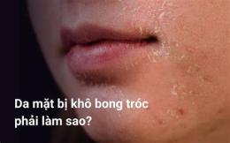 hướng dẫn sử dụng da mặt khô bong tróc mùa đông