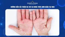 hướng dẫn sử dụng da tay bị bong tróc là bệnh gì