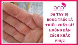 hướng dẫn sử dụng da tay bị bong tróc là thiếu chất gì
