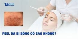 hướng dẫn sử dụng dấu hiệu peel da bị bỏng