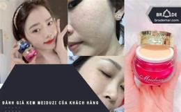 hướng dẫn sử dụng kem meiduzi có bong da không