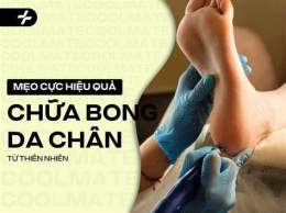 hướng dẫn sử dụng mẹo chữa bong da chân