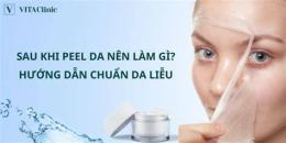 hướng dẫn sử dụng peel da đang bong nên làm gì