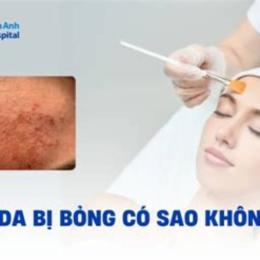 peel da bị bỏng