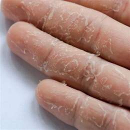 tính năng nổi bật da tay bị khô bong tróc