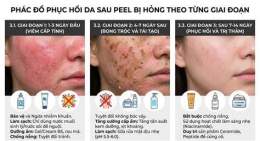 tính năng nổi bật peel da bị bỏng