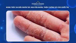tính năng nổi bật thuốc đặc trị bong tróc da tay
